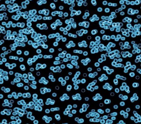 Flotex Sottsass 990105 Bacteria ID:2756, 1