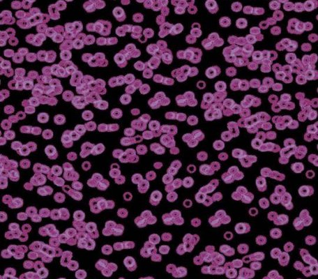 Flotex Sottsass 990104 Bacteria ID:2757, 1