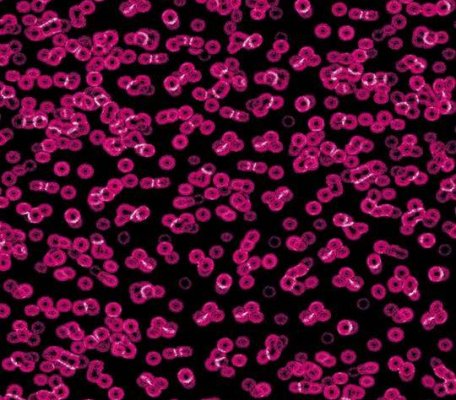 Flotex Sottsass 990101 Bacteria ID:2758, 1